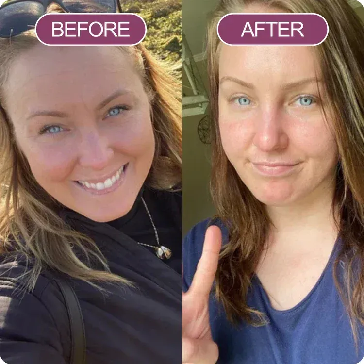 Avant / après : transformation du visage d'une cliente