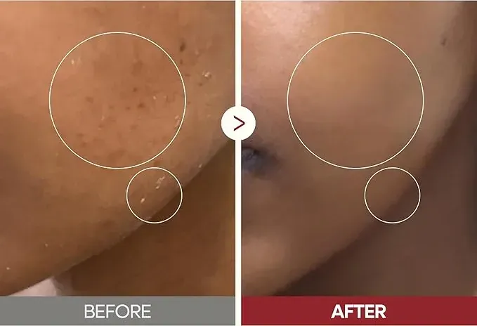 Avant / après : texture et éclat de la peau en gros plan